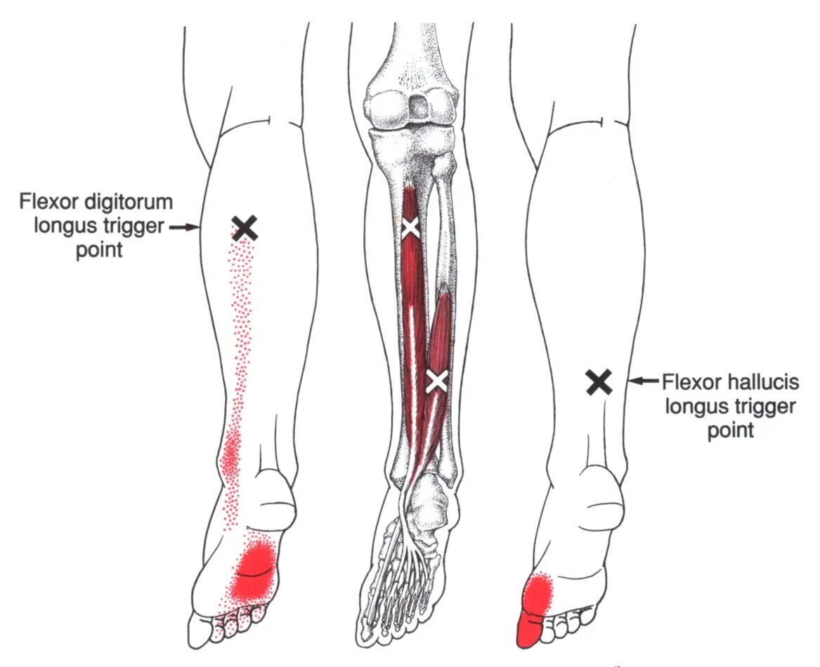 Leg point