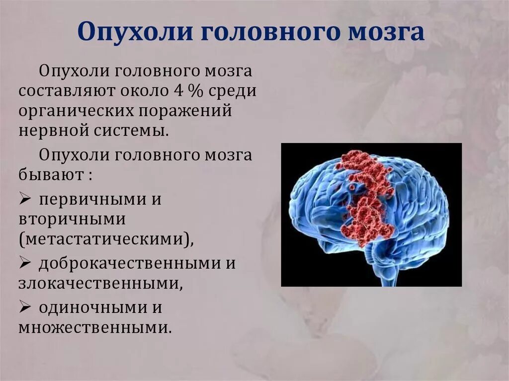 Симптомы опухоли головного мозга на ранних стадиях. Симптомов характерны для опухолей головного мозга. Опухоль головного мозга симптомы. Причины опухоли головного мозга.