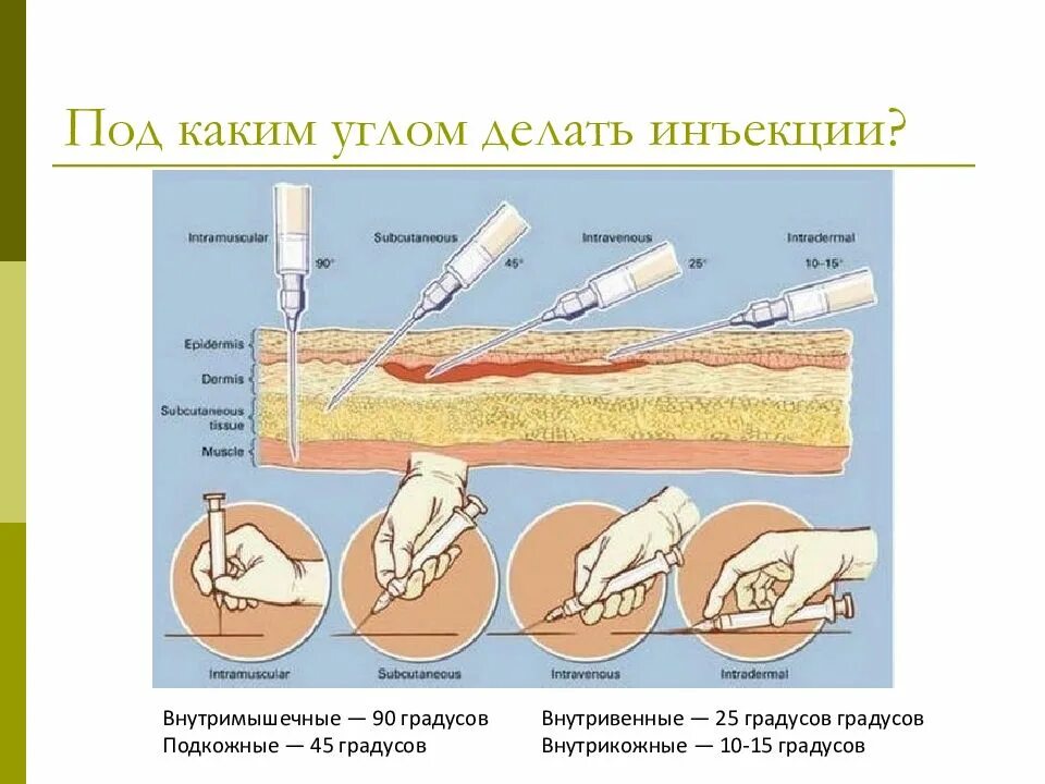 Внутривенно градусы. Введение иглы при внутримышечной инъекции. методы внутрикожные подкожные внутримышечные инъекции. под каким углом делается укол в ягодицу. подкожно внутрикожно внутримышечно внутривенно.
