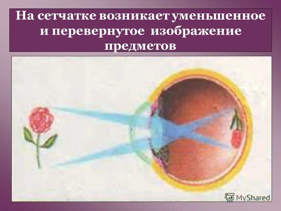 оптическая система глаза создает изображение на сетчатке. изображение на сетчатке получается перевернутым и уменьшенным. перевернутое изображение на сетчатке глаза. на сетчатке возникает изображение предмета. изображение на сетчатке уменьшенное и перевернутое.