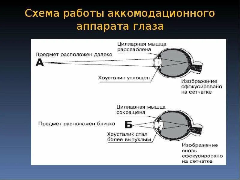 Схема рефлекторной дуги аккомодации. Рефлекторный путь зрачкового рефлекса. Схема рефлекса аккомодации. Аккомодационный аппарат.