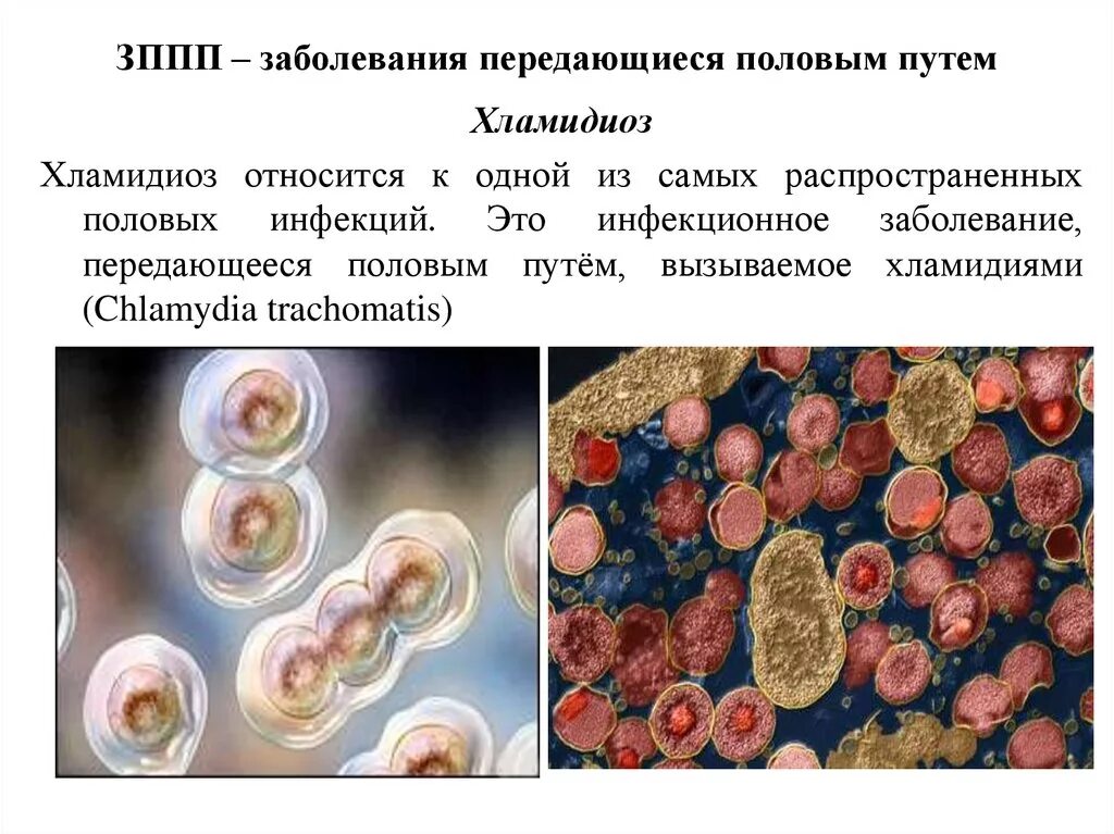 Выберите заболевания передающиеся половым путем. Заболевания передающиеся половым путем. Заболевания которые передаются половым. Инфекции передаваемые половым путём. Заболевания передающиеся половым путем (ЗППП).