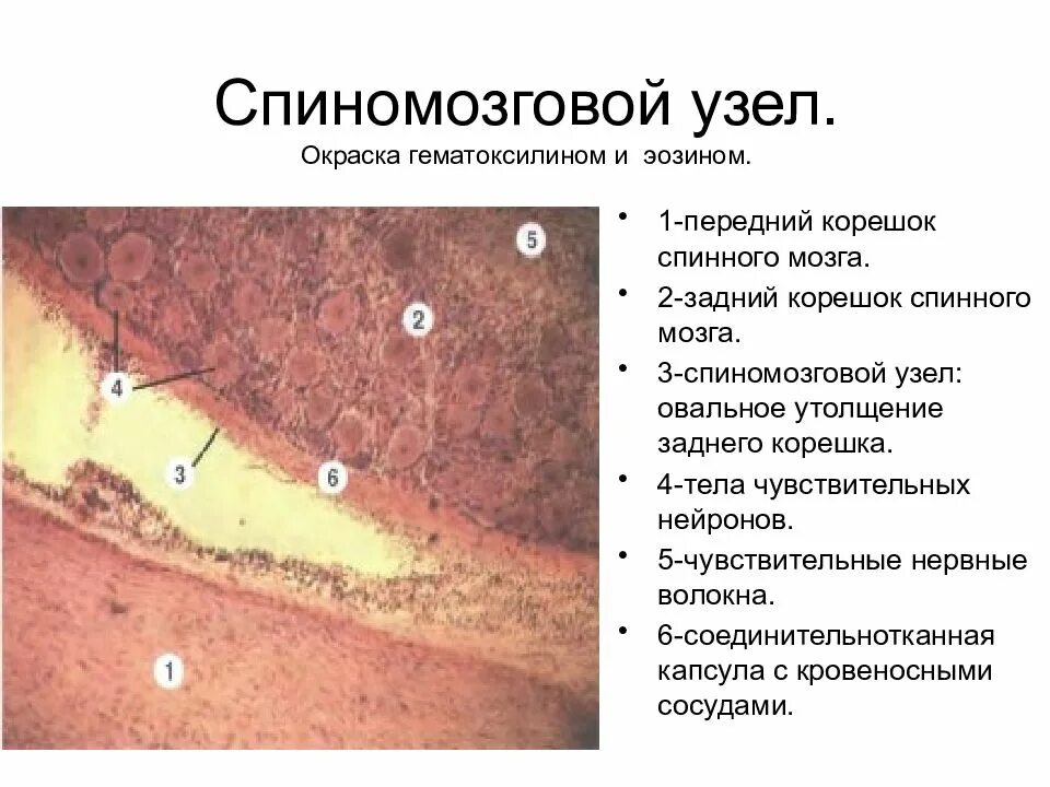 Клетки спинномозгового узла. Спинномозговой ганглий гистология препарат. Спинномозговой узел окраска гематоксилин-эозином. Спинальный ганглий гистология препарат. Гистологический препарат спинномозгового узла.