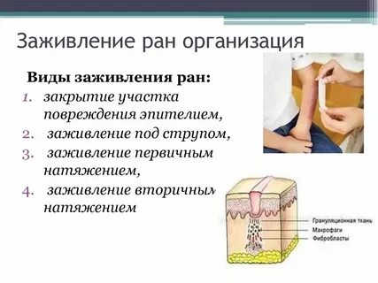 Через сколько заживает ранка