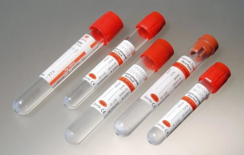 Пробирка с биоматериалом. Пробирки bd vacutainer. пробирка для сбора(посева) мочи vacutainer10 мл,16*100 мм, bd (455049). пробирки бектон дикинсон. вакуумные пробирки rustech.