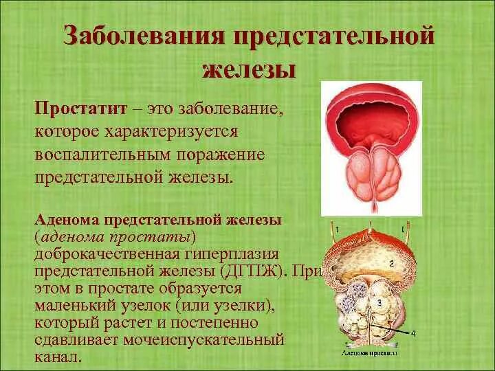 Предстательная железа болезни лечение