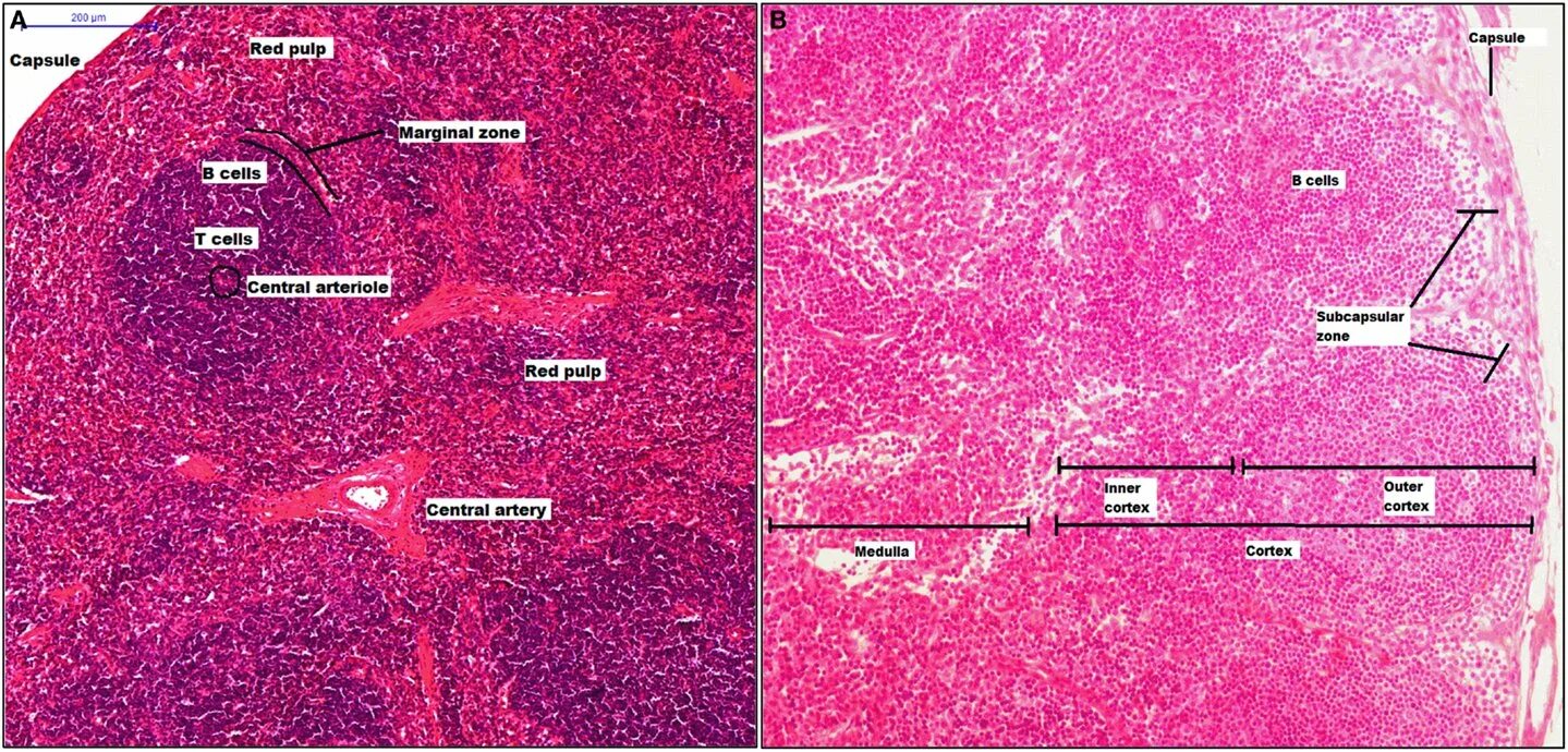 Селезенка гистология препарат. Белая пульпа селезенки гистология. Красная пульпа селезенки гистология. Зоны селезенки гистология. Стволовые клетки селезенки