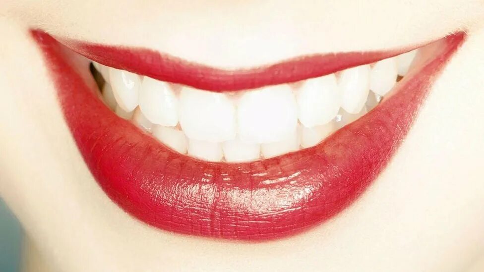 красивая улыбка здоровых зубов желтый фон. белые зубы белая кожа. губы с зубами. девушка на однотонном фоне с белыми зубами. девушка с красивыми зубами.