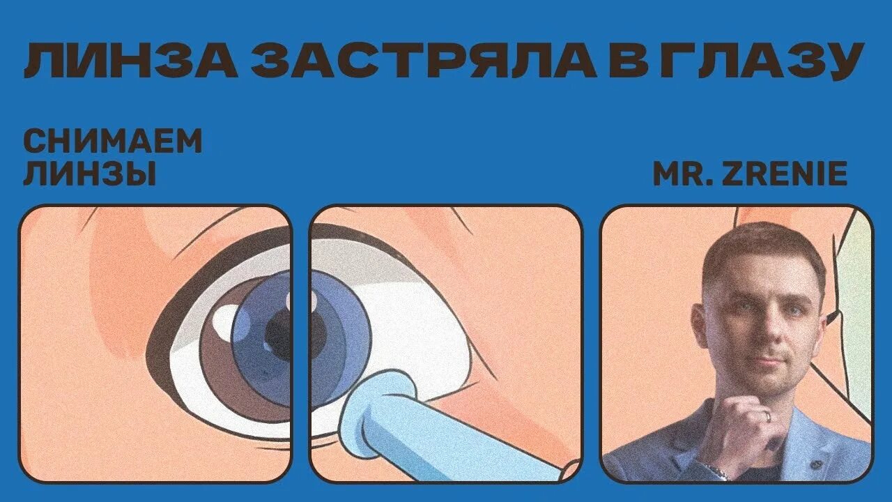 Как достать линзу из века