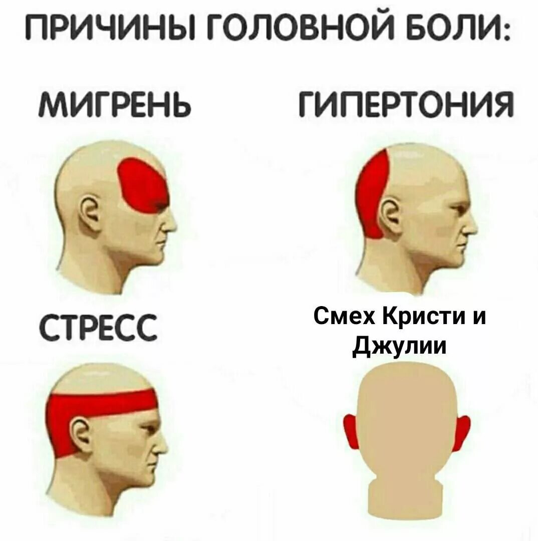 Типы головной боли. Головная боль сзади головы. Головная боль локализация. Вызывает головную. Головная боль мем.
