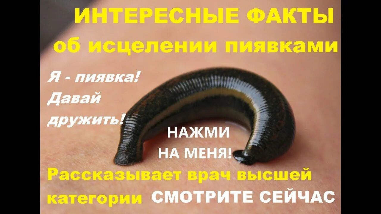 Интересные факты о пиявках. Медицинская пиявка интересные факты. От каких болезней пиявки