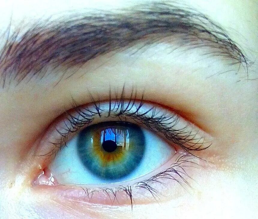 Голубые глаза часто встречаются