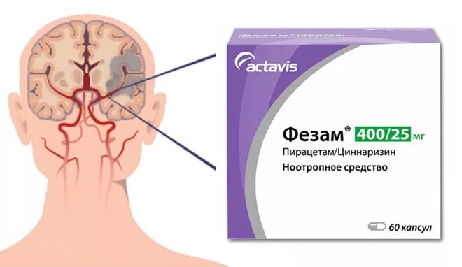 Лекарства для восстановления инсульта. Лекарство от инсульта головного мозга. Таблетки при инсульте. Таблетки для мозга после инсульта. Таблетки после инсульта для восстановления мозга.