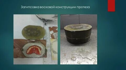 Гипсовка в кювету