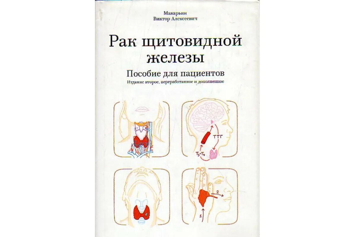 Книга щитовидная железа. Опухоль щитовидной железы признаки. Скрининг щитовидной железы. Опухоль щитовидной железы. Рак щитовидной отзывы.