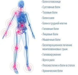 Неврологические головные боли