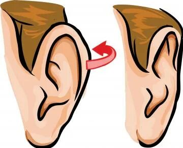Protruding ears