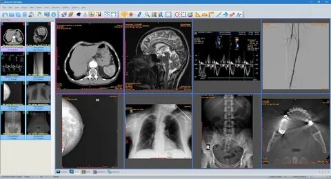 DICOM Viewer Cloud Model Access | Instant Access to Medical Images