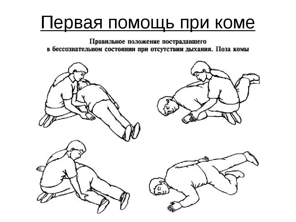 Первая кома техника