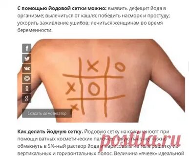 Йодная сетка на горле