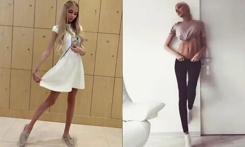 Анорексия шишков
