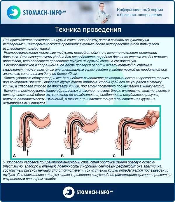 Процедура прямой кишки