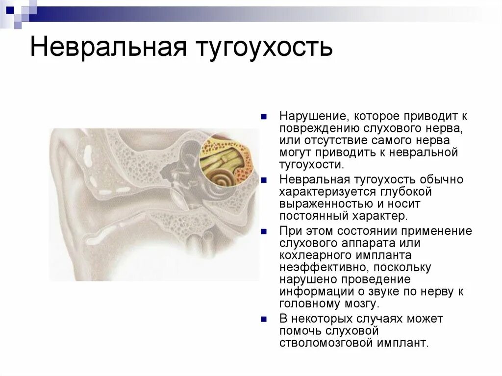 Отосклероз и тугоухость. Тугоухость кт. Тугоухость кт. Тугоухость кт. Кт височной кости при мастоидите.