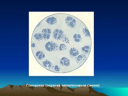 Диплококки в мазке у женщин