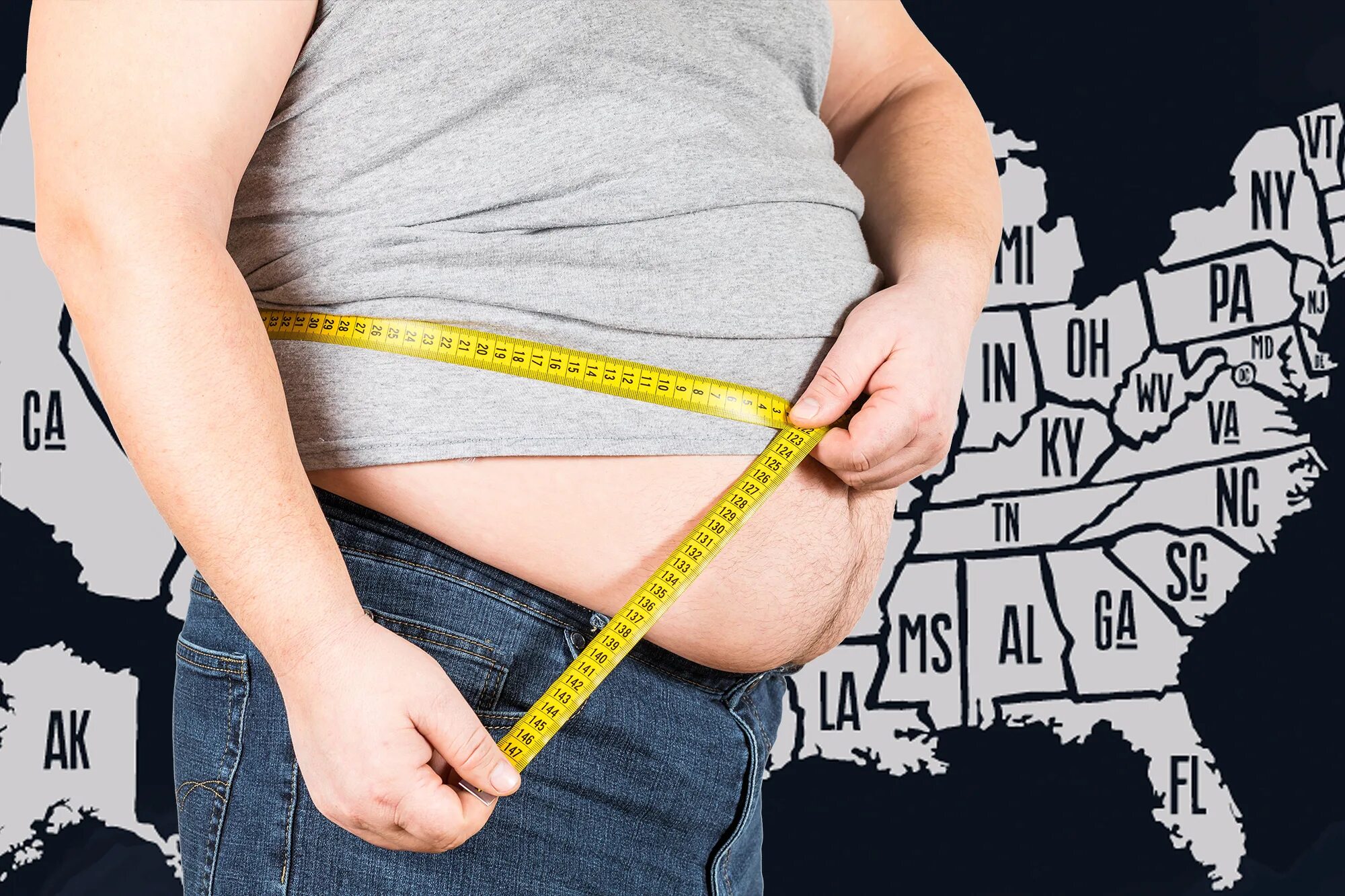 Obese бренд. Obesity reasons. Лишний вес и ожирение. Consequences of obesity. Ожирение картинки.