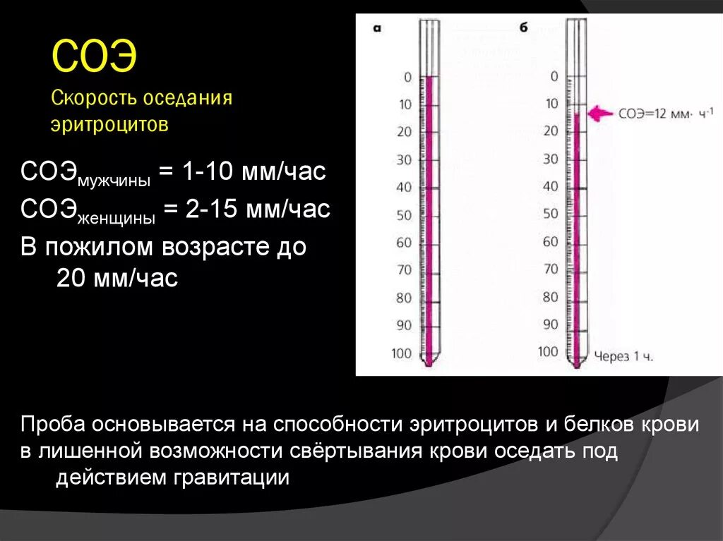 Повышение соэ у мужчин. Методика определения СОЭ физиология. Методика измерения СОЭ В крови. Скорость оседания эритроцитов (СОЭ). Механизм. СОЭ 1 мм/ч.