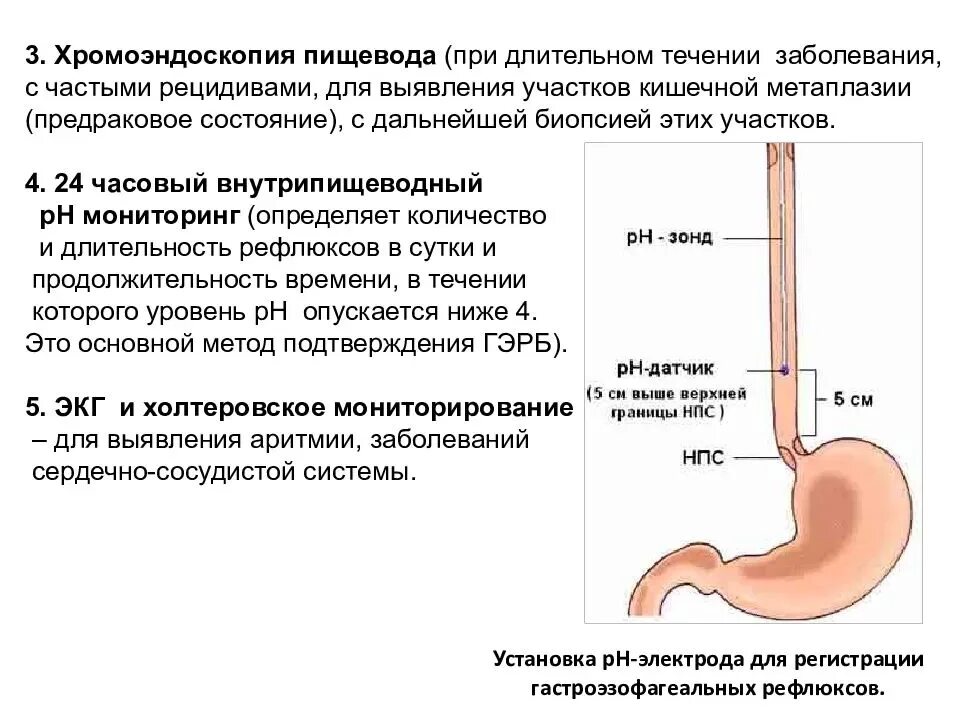 Времени в пищевода