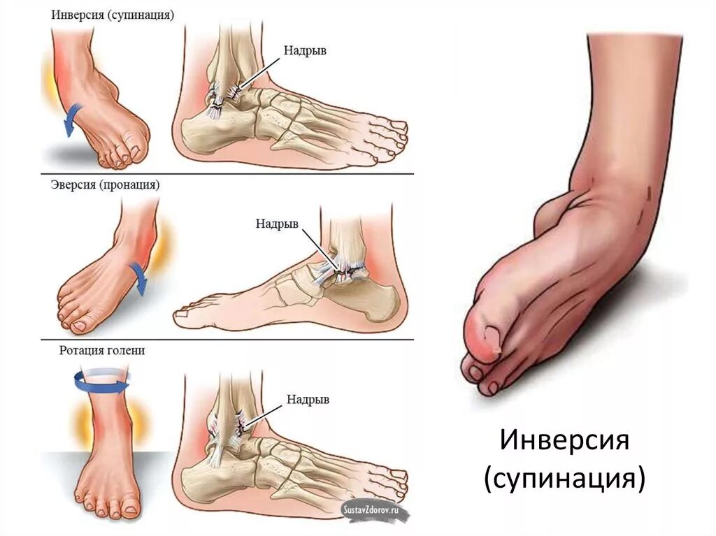 Движения в голеностопном суставе