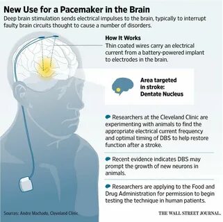 Behavioral Neuroscience, Deep Brain Stimulation, Disorders, Circuit, Recove...