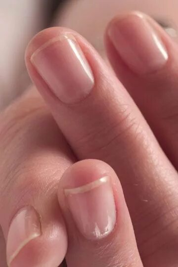 Как должны выглядеть здоровые ногти на руках Permanently closed: Beauty Nails, nail salon, Moscow, Vernadskogo Avenue, 86Б