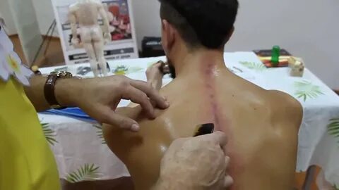 Массаж скребком отзывы