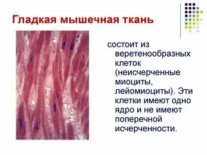Мышечная ткань состоит из веретеновидных клеток