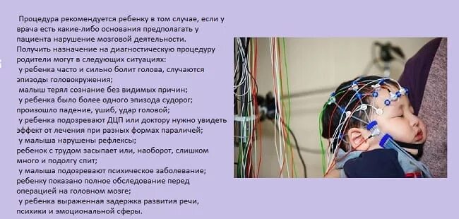 Ээг вм. ЭЭГ мониторинг головного мозга. Энцефалограмма детям. Электроэнцефалография у детей. ЭЭГ головного мозга ребенку.