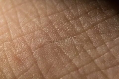 Куда ведут поры на ладонной поверхности