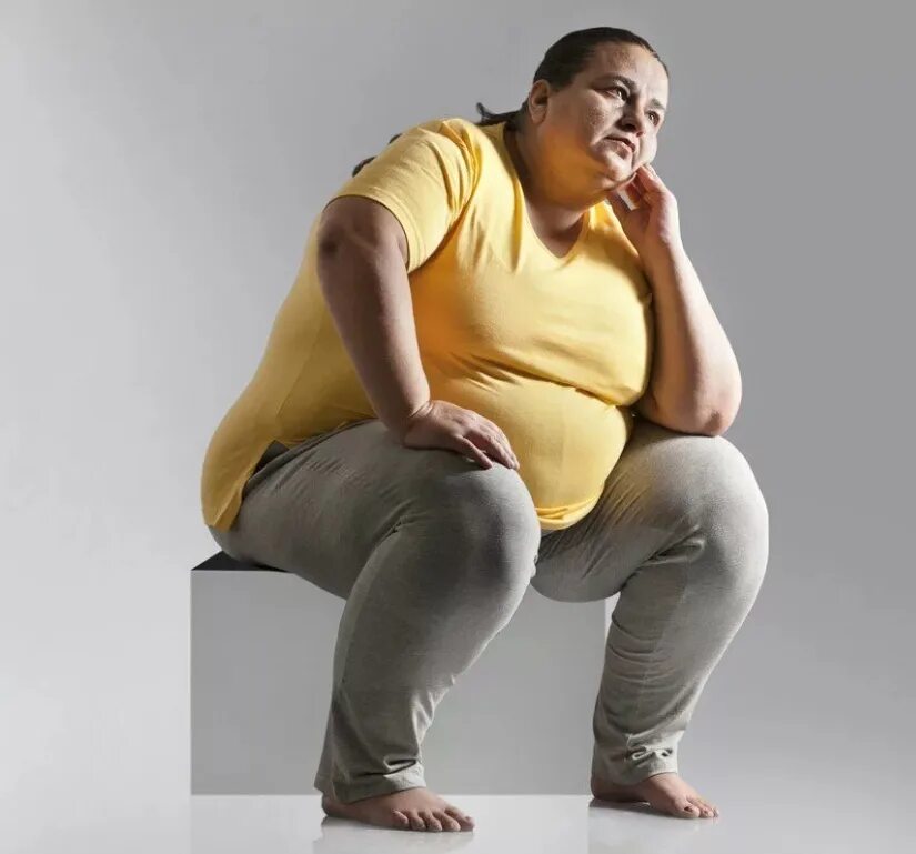 Ожирение шеи. Ожирение синдром пиквика. Женщина на диете. Ожирение шеи. Человек с тремя подбородками.