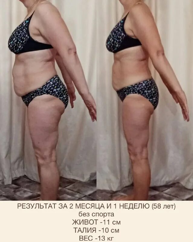 Похудеть на гормонах. Активно худеем. Как похудеть после гормонов. Похудение после резекции. Похудение на диете дряблая кожа.