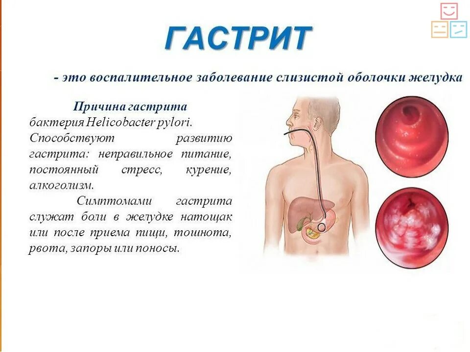 Почему болит мясо. Гастрит причины симптомы.