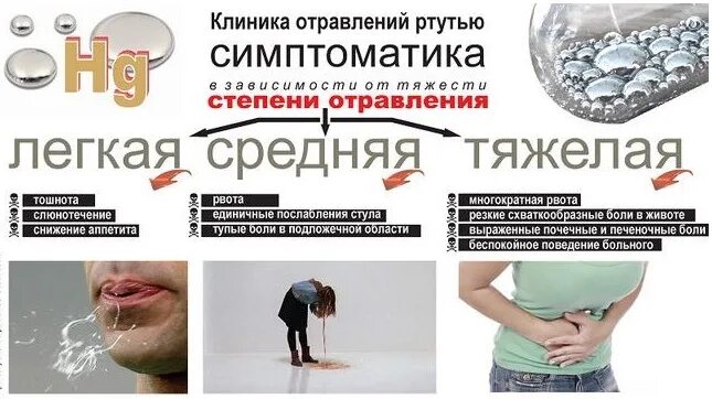 Синдромы отравления ртутью. Признаки отравления ртутью. симптомы при отравлении ртутью. клинические симптомы отравления ртутью. симптомы от отравления ртутью от градусника симптомы.