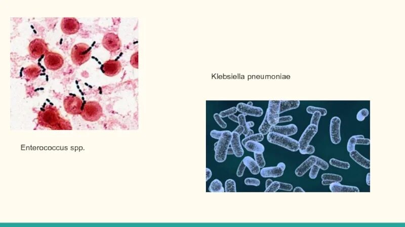 Кишечная палочка энтерококк. Клебсиеллы микробиология. Энтерококк SPP.