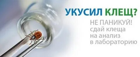 Лаборатория клеща на анализ