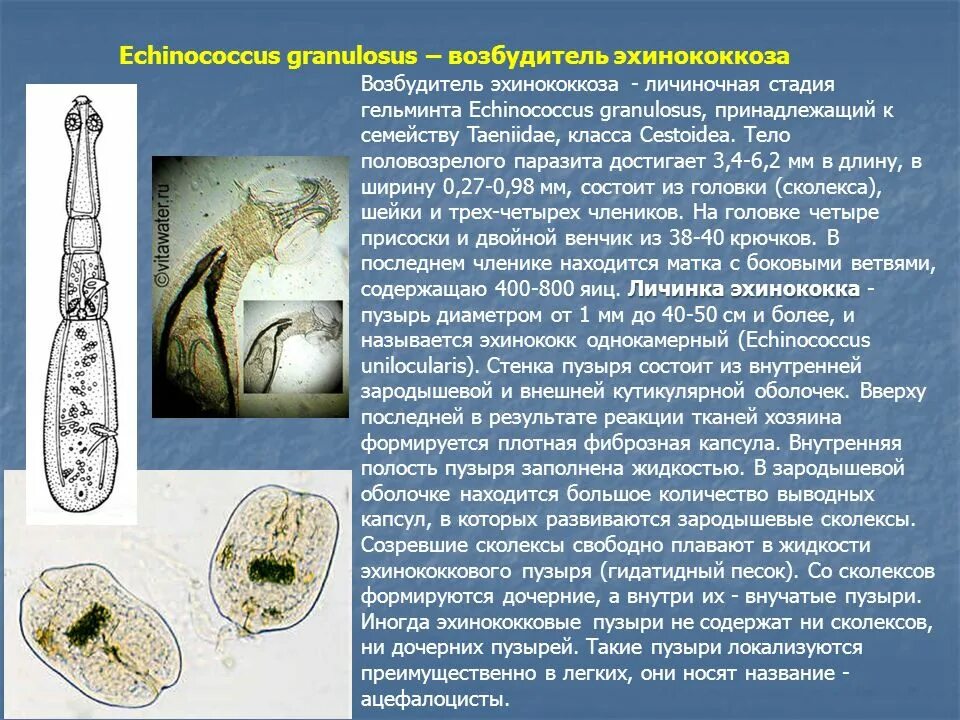 Эхиноккоз