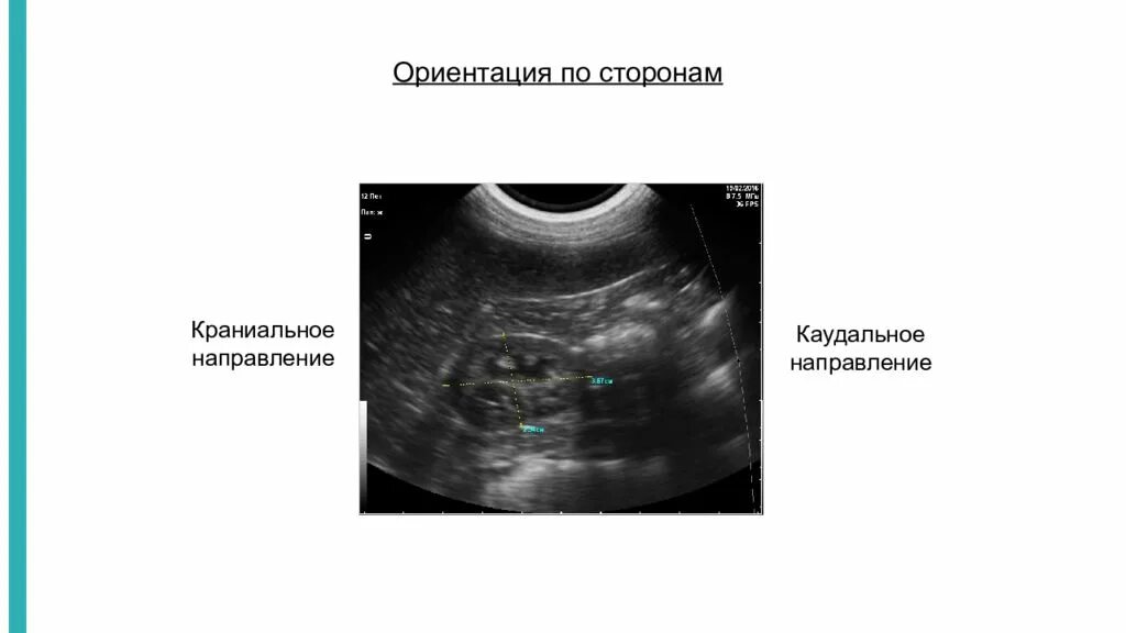 Узи в каменском. Физические основы УЗИ. Ориентация изображения по УЗИ. УЗИ презентация. Основы УЗИ презентация.