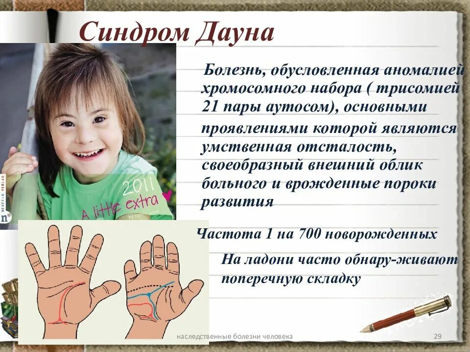 Как узнать синдром дауна. Болезнь дауна по мкб 10. синдром дауна код по мкб. синдром дауна мкб 10 код. синдром дауна презентация.