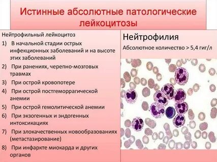 Лейкоциты сплошь что это