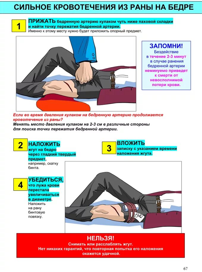 Артериальное кровотечение в области бедра. Алгоритм действий при повреждении бедренной артерии кровотечение. Оказание первой помощи при повреждении бедренной артерии. Кровотечение из бедренной артерии первая помощь. Артериальное кровотечение из бедра.
