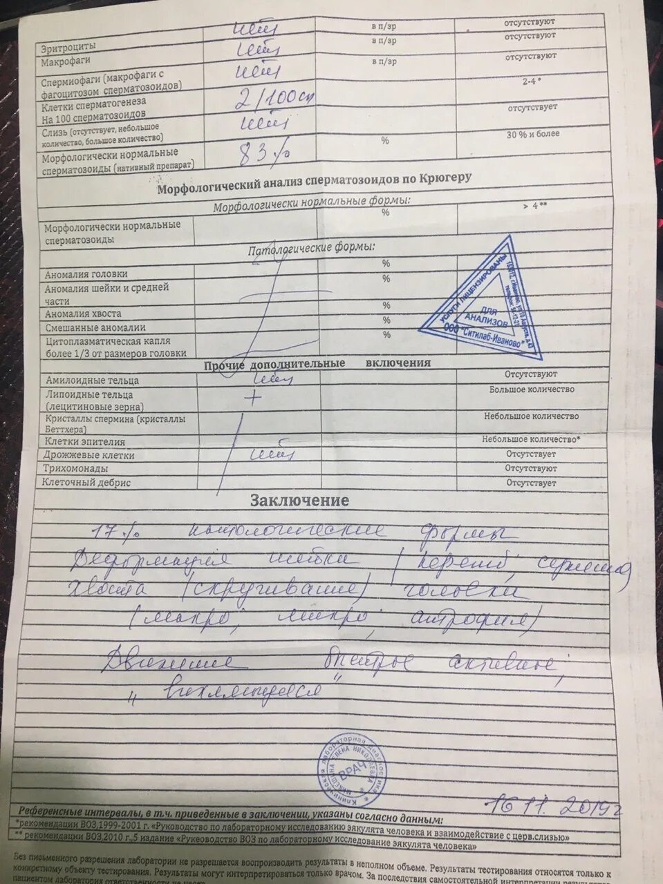 Анализ на спермограмму. Как сдают анализ на спермограмму. Спермограмма как сдавать. Анализ на спермограмму. Азооспермия спермограмма.